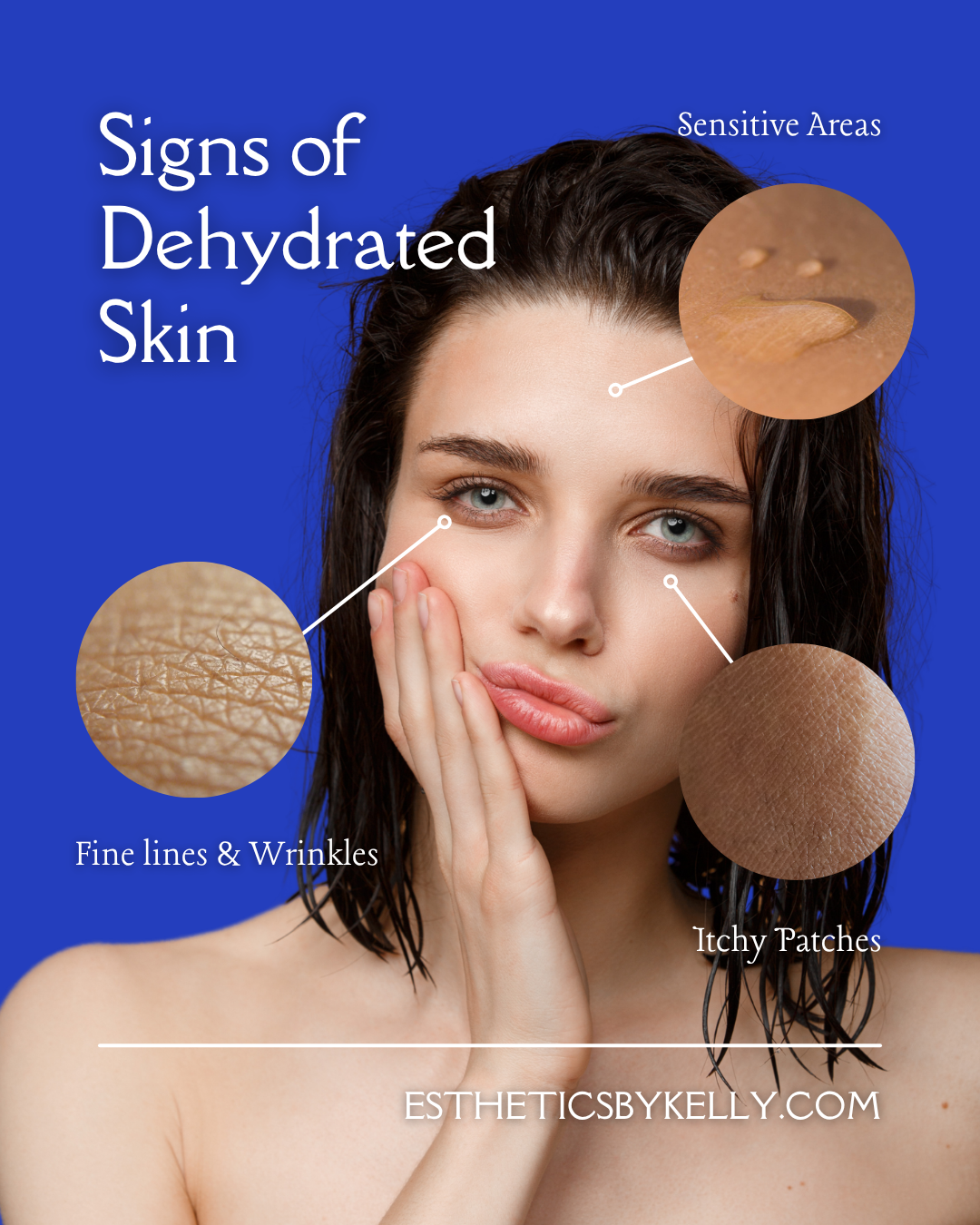 SIGNS OF DEHYDRATED SKIN (AND WHAT TO DO ABOUT IT)