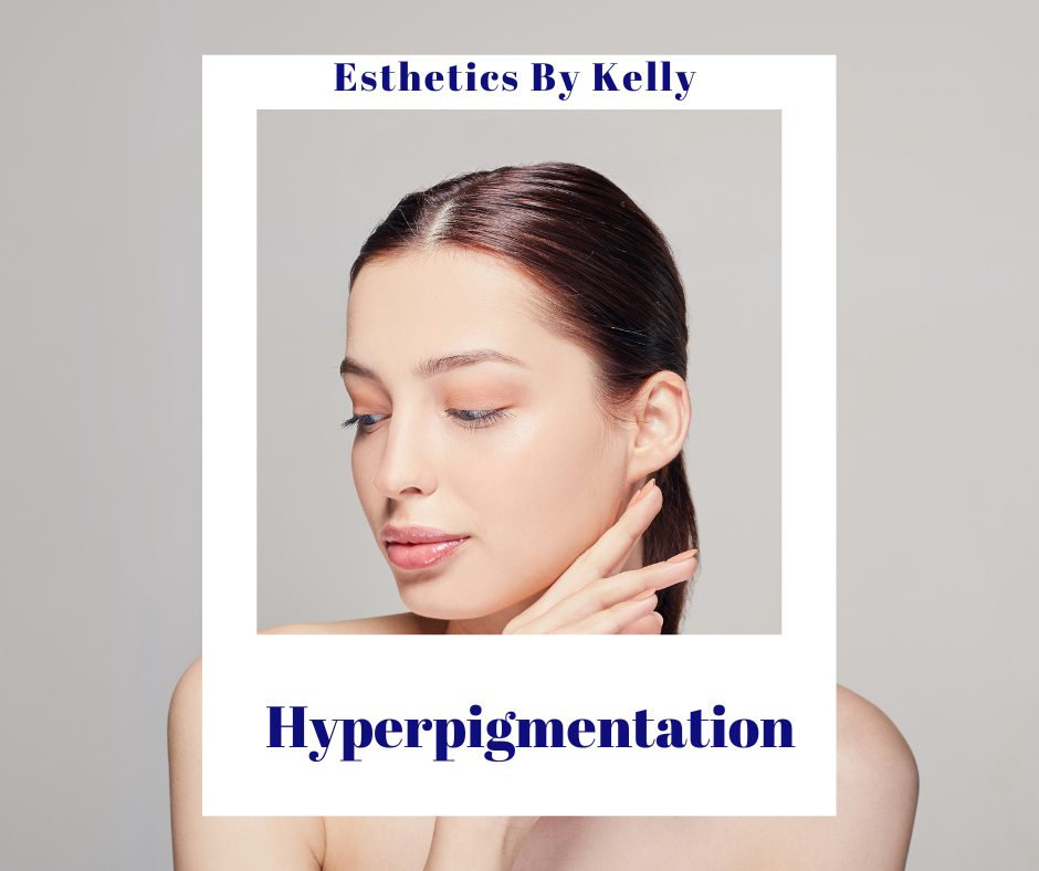 Woman with clear skin demonstrating hyperpigmentation skincare focus, neutral background