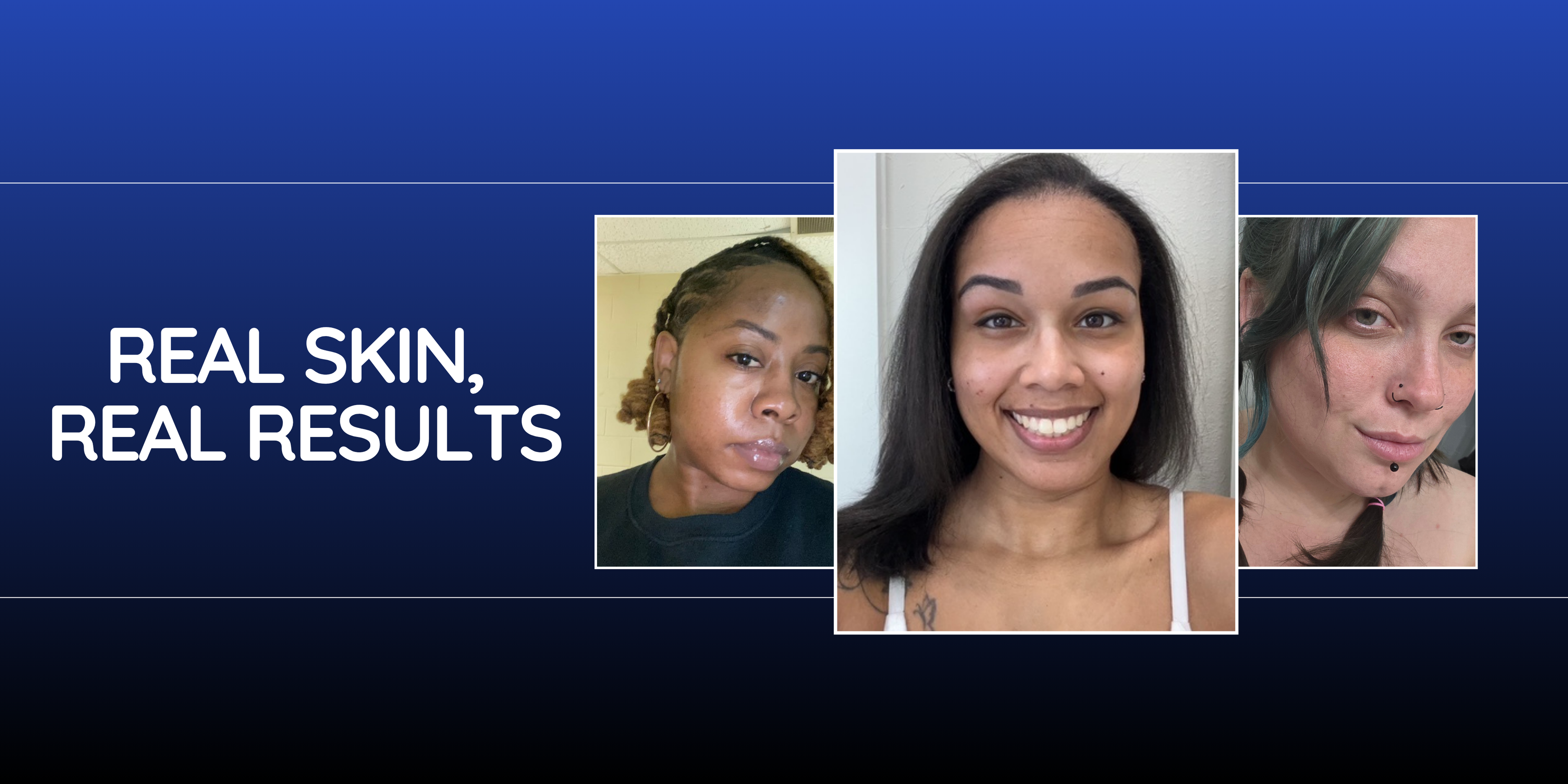 Advertisement for skincare products with three women's faces on a blue background.